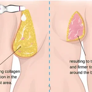 AEXZR™ Breast Enhancing Ampoule