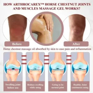 ArthroCareX™ Horse Chestnut Joints and Muscles Massage Gel