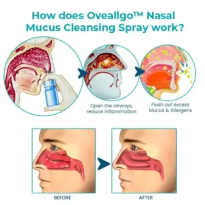 Fivfivgo™ Nasal Mucus Cleansing Spray