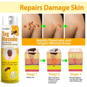 LOVILDS™ TagRecede Bee Poison Treatment Spray