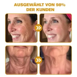 Spzv™ Botox Bienenvenom Faltenentfernungscreme