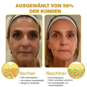 Spzv™ Botox Bienenvenom Faltenentfernungscreme