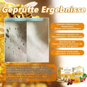 Vsoxa™ Bienengift Waren & Muttermalenfernung Creme