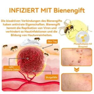 Vsoxa™ Bienengift Waren & Muttermalenfernung Creme