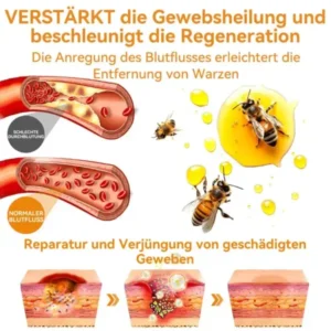 Vsoxa™ Bienengift Waren & Muttermalenfernung Creme