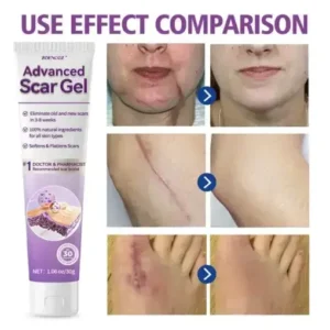 Zoencgz™ Advanced Scar Gel