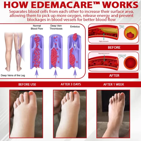 EdemaCare™ Horse Chestnut VenoLymph Massage Cream