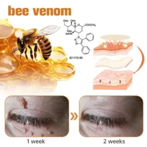 Fivfivgo™ WartGone Bee Venom Treatment Patch